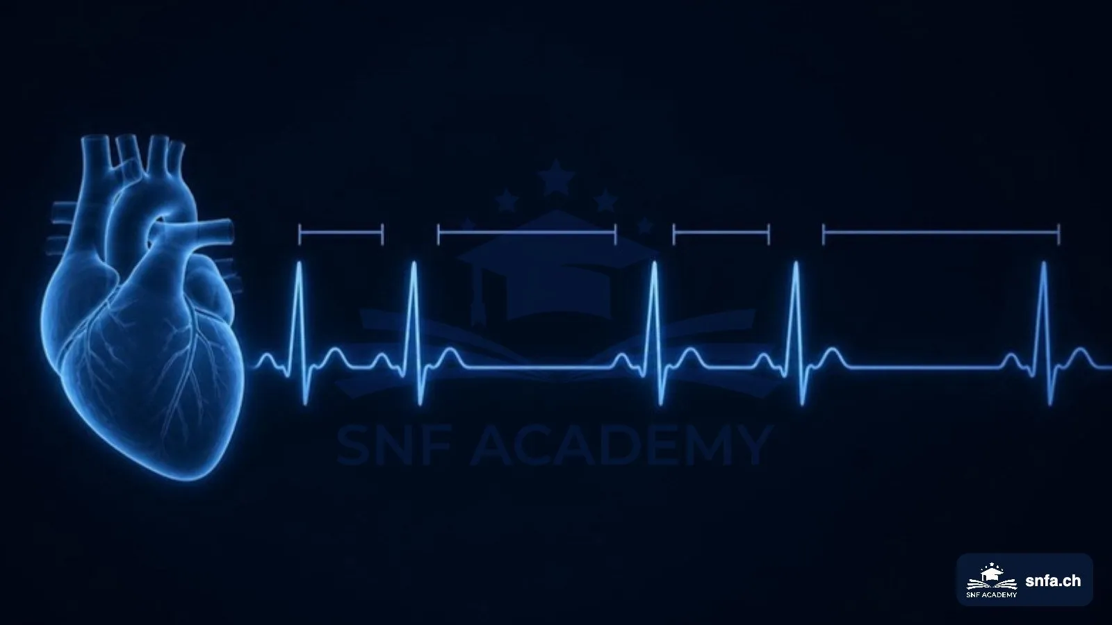 Herzfrequenzvariabilität: EKG-Kurve mit unterschiedlichen Abständen zwischen den Herzschlägen – SNF Academy